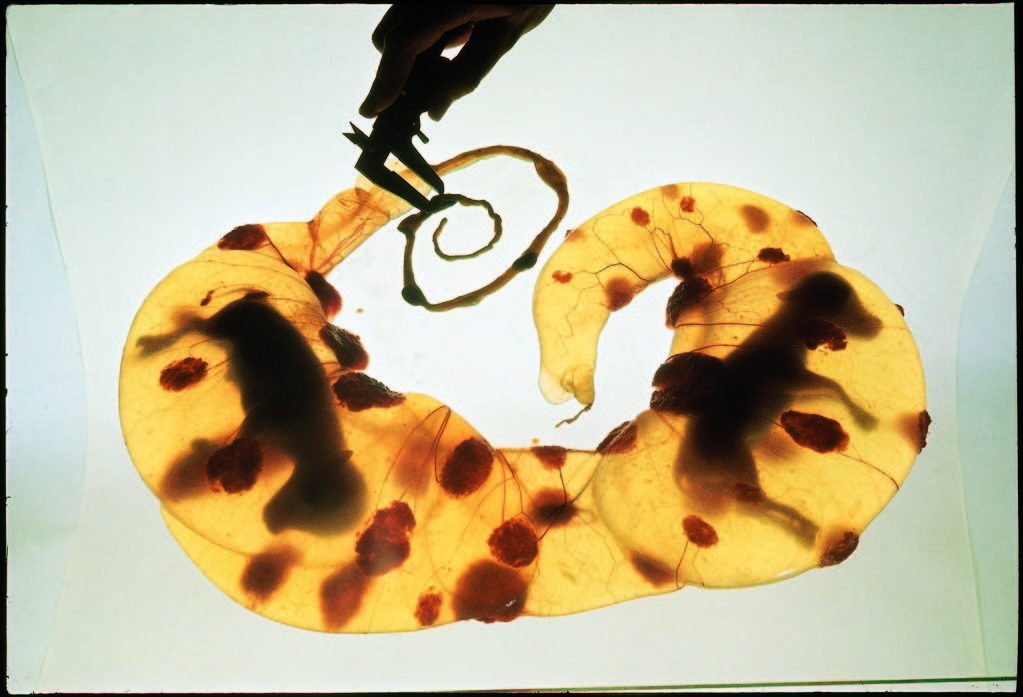 Technician at Washington State University measuring lumps of cow fetuses. (Photo by Oscar Fritz Goro/The LIFE Picture Collection © Meredith Corporation)